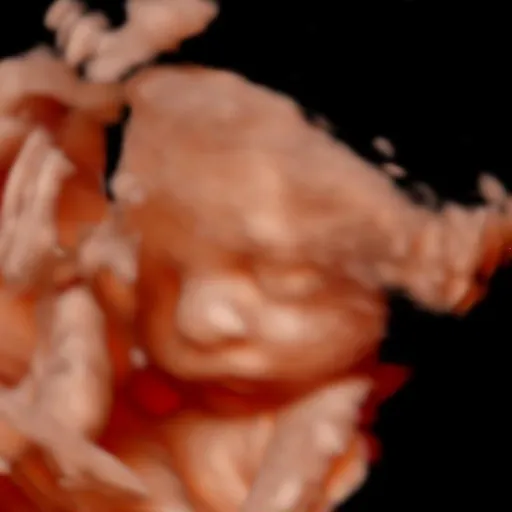 Original ultrasound 2