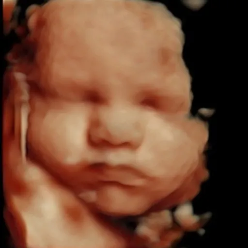 Original 3D ultrasound image before AI 8K enhancement